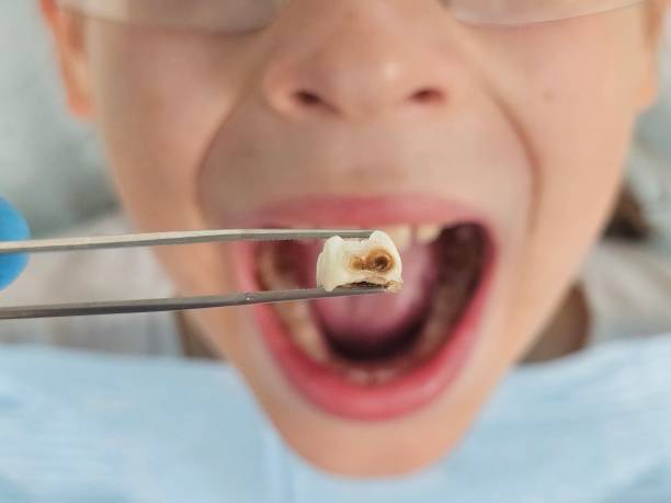 Best Emergency Care for Gum Disease in Itasca, IL